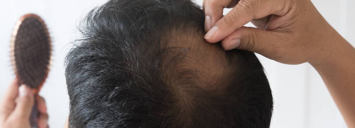 Quelles sont les causes de l'amincissement et de la chute des cheveux ?