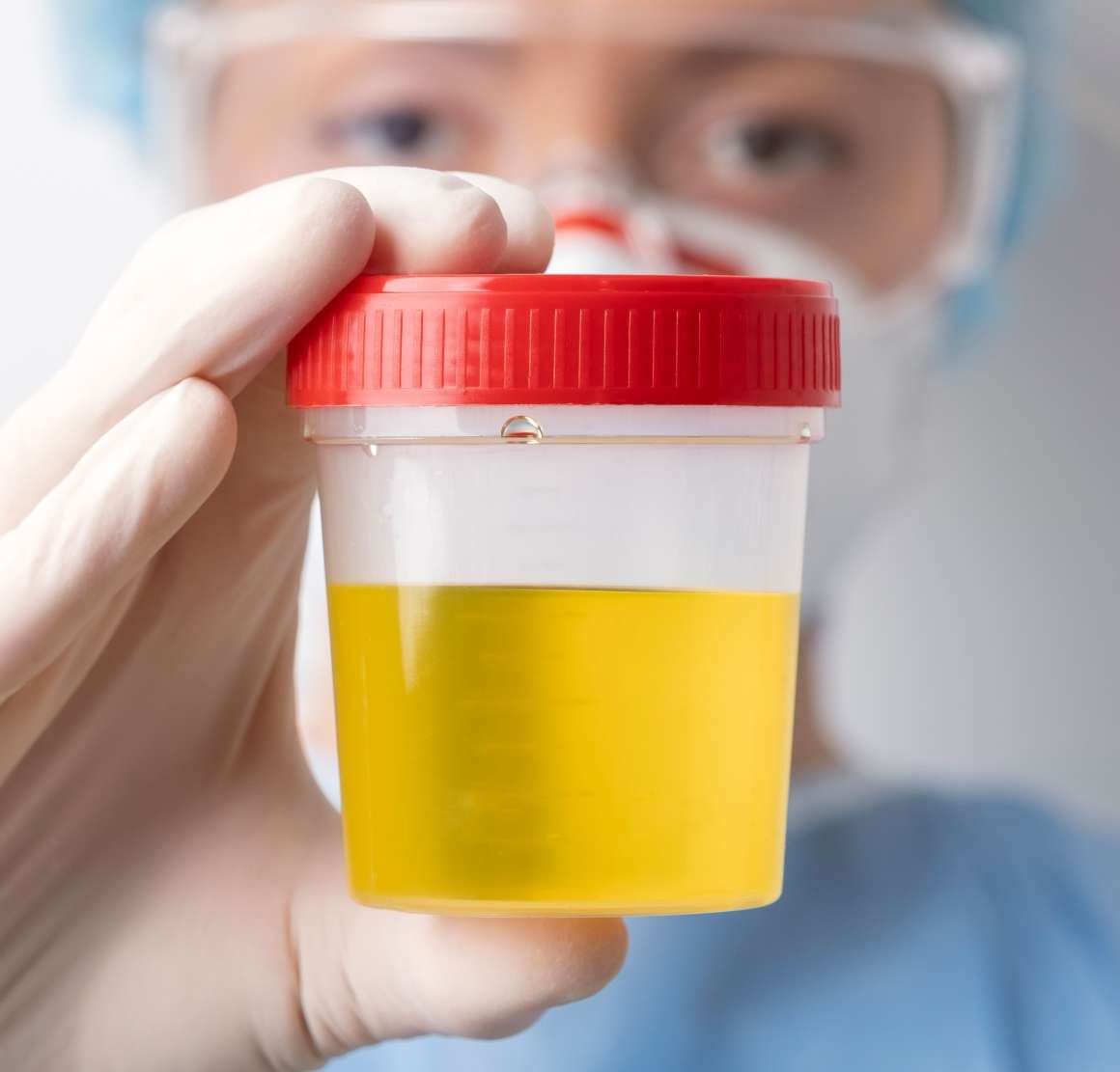 combien de temps le cbd est-il détectable dans l'urine ?