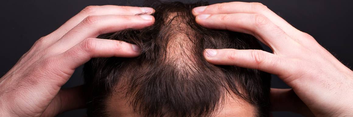 Réparation des follicules pileux endommagés pour une croissance saine des cheveux